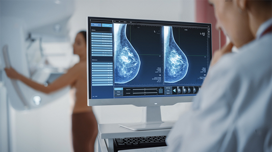 Computer Screen in Hospital Radiology Room: Beautiful Multiethnic Adult Woman Standing Topless Undergoing Mammography Screening Procedure. Screen Showing the Mammogram Scans of Dense Breast Tissues.